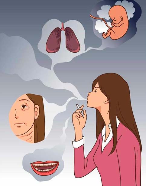 담배 핀 적 없어도…여성도 눈여겨 볼 폐암의 징후 7가지